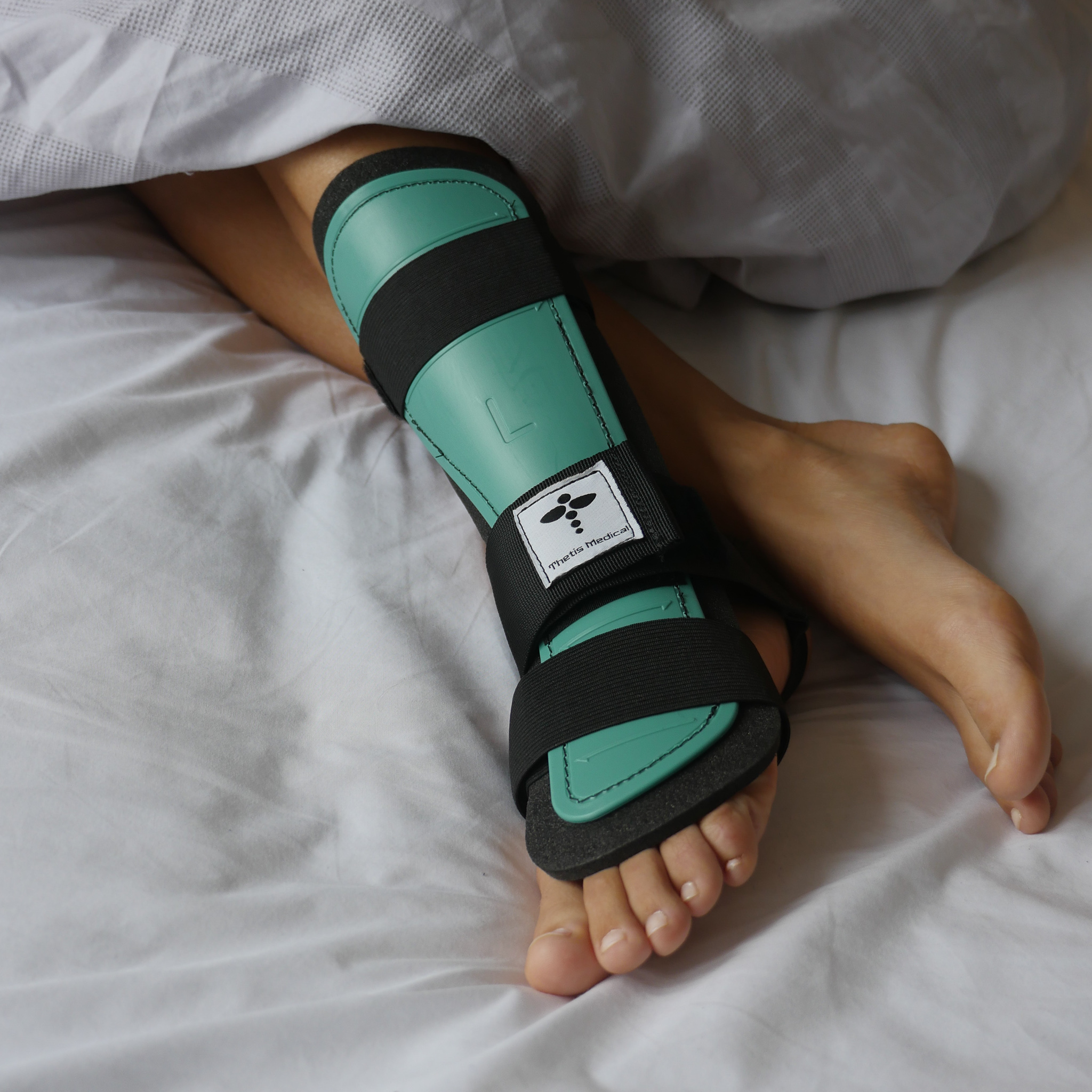 Patient wearing the Achilles Tendon Rupture Splint